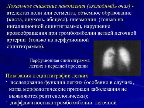 Понятие и сущность очага повышенного накопления РФП