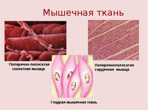 Поперечно полосатая скелетная мышца