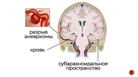 Поражение сосудов