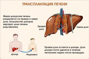 Последствия для печени