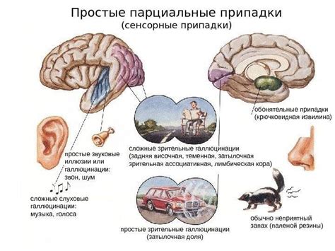 Последствия и прогноз при парциальных судорогах с вторичной генерализацией