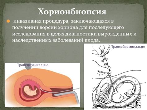 Последствия колецевидного хориона для ребенка