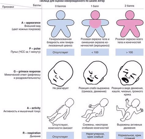 Последствия незамеченного пивка 1 степени у новорожденных