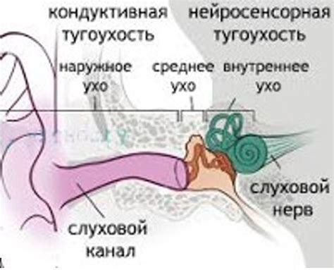 Последствия отсутствия лечения тугоухости