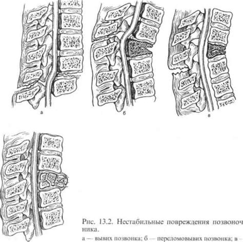 Последствия травмы