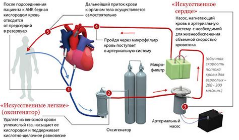 Постановка искусственного кровообращения