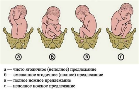 Потенциальные проблемы при отсутствии родов