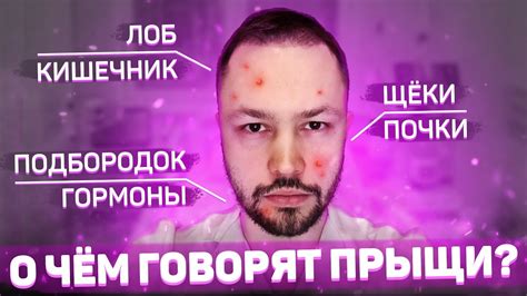 Почему появляются прыщи на кончике носа?