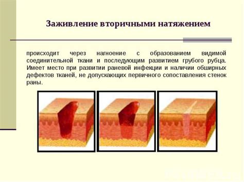 Появление воспаления и отека