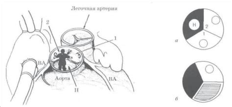 Правый синус облитерирован