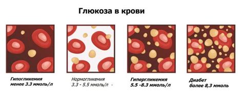 Предотвращение повышения глюкозы в крови