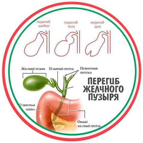 Признаки дисхолии: проблемы с восприятием и осмыслением слов