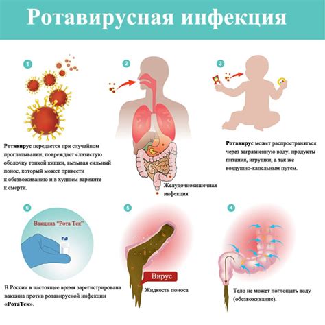 Признаки и симптомы инфекции вшами у ребенка