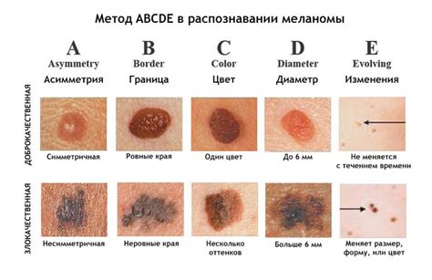 Признаки наличия жидкости под кожей