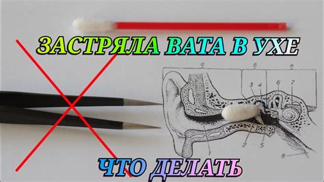 Признаки того, что вата застряла в ухе