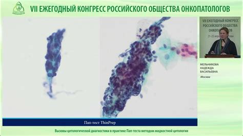 Принцип работы жидкостной цитологии