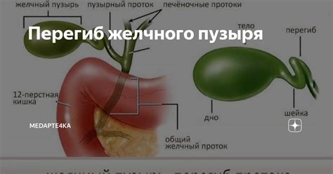 Причины аномалии желчного пузыря у ребенка