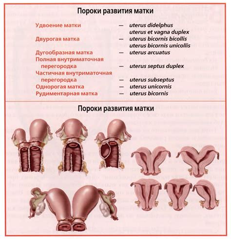 Причины близкого расположения яичника и матки