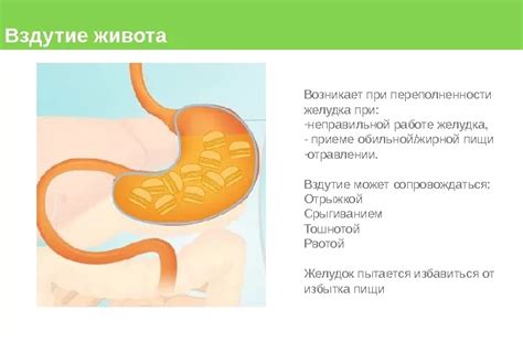 Причины вздутия живота после поедания большого количества пищи