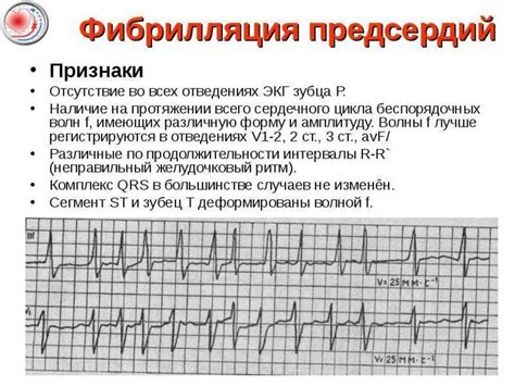 Причины возникновения: что вызывает аритмию и тахикардию?