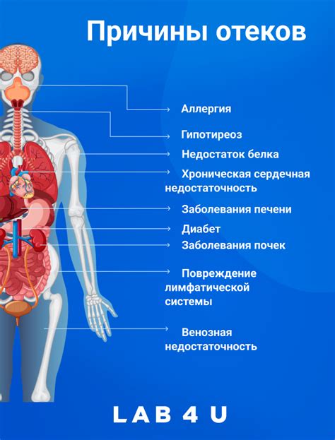 Причины возникновения Кхх