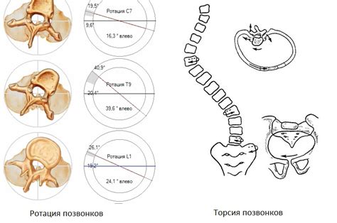 Причины возникновения дискоостеофитического комплекса C3-C4