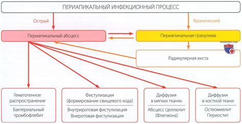 Причины и механизмы развития