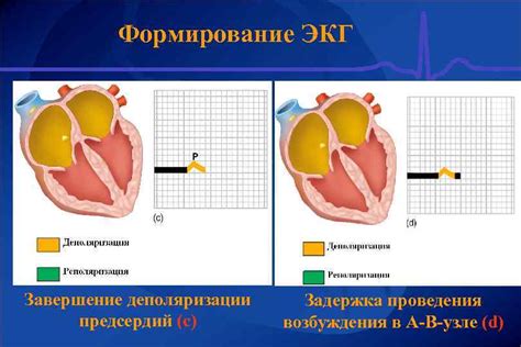 Причины и последствия изменений процесса деполяризации предсердий