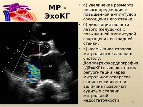 Причины и симптомы дилатации