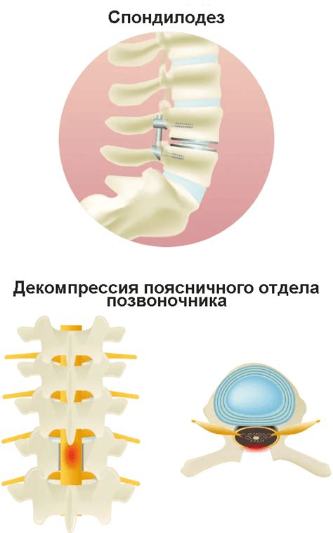 Причины и симптомы проглатывания дуги