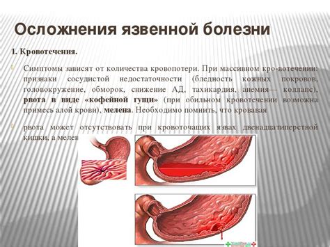 Причины кровотечения и его последствия