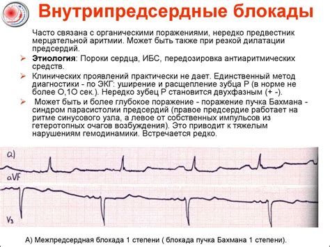 Причины недостаточной проводимости