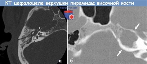 Причины поломки верхушки