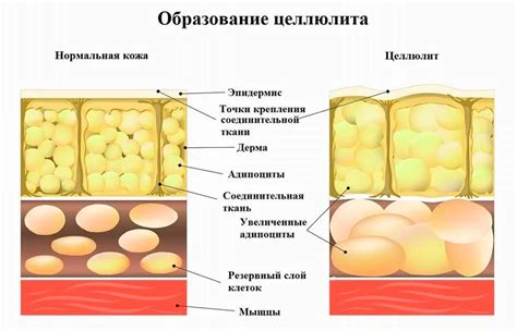 Причины появления инфратенториальных очагов