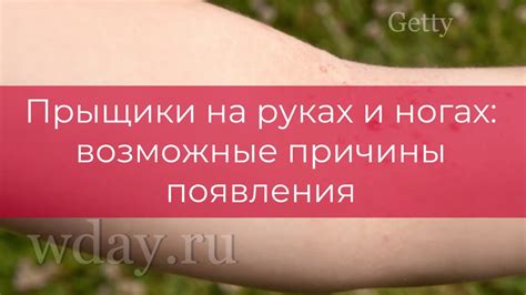 Причины появления прыщей на руках и ногах