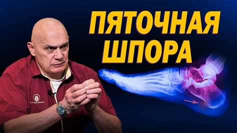 Проблема боли в пятках