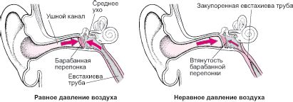 Проблемы с ушными секрециями