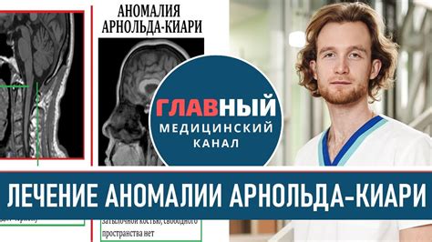 Прогноз для пациентов с аномалией Арнольда-Киари 2 степени