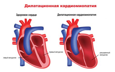 Происхождение аритмии: врожденные и приобретенные причины