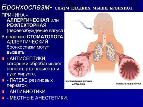 Прорывание воздуха через спазм бронхов