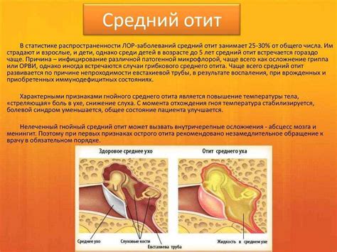 Профилактика воспаления левого уха