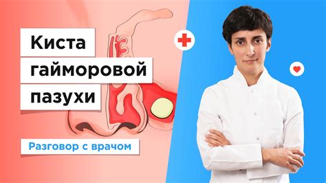 Профилактика грибкового поражения гайморовой пазухи