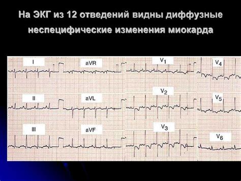 Профилактика изменения миокарда левого желудочка