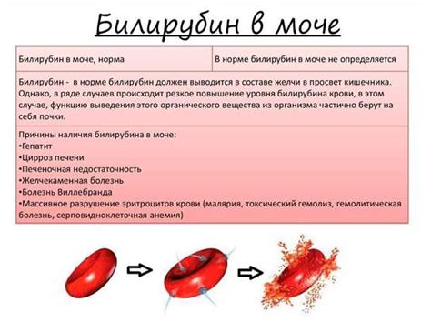 Профилактика повышенного билирубина: