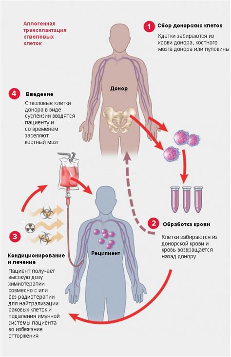 Процедура костного мозга на донорство