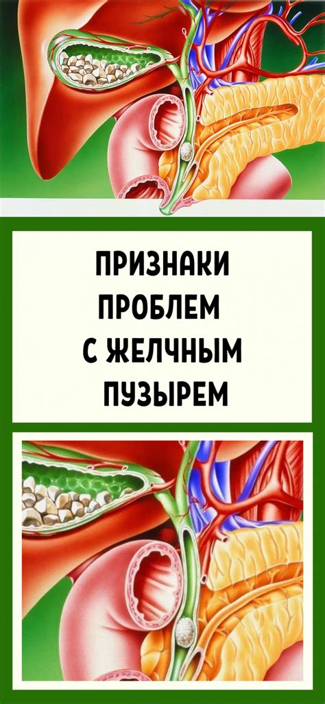 Пульсация в связи с желчным пузырем