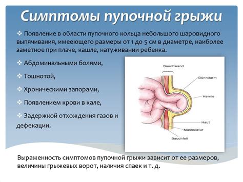 Пупочная грыжа и выделение из пупка