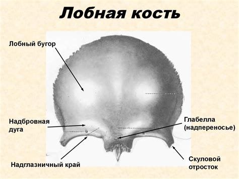 Раздел 1: Особенности слепых отверстий лобной кости