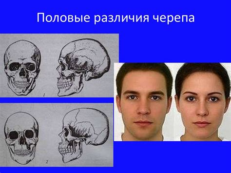 Различия в строении головы и рогов