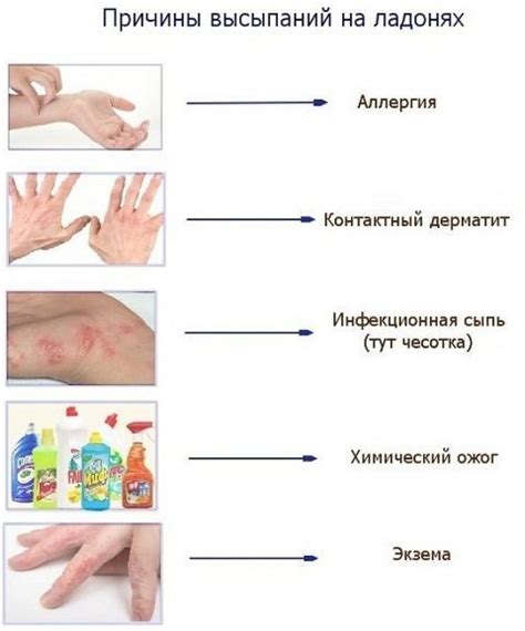 Ребенок и волдыри: в чем состоит проблема?